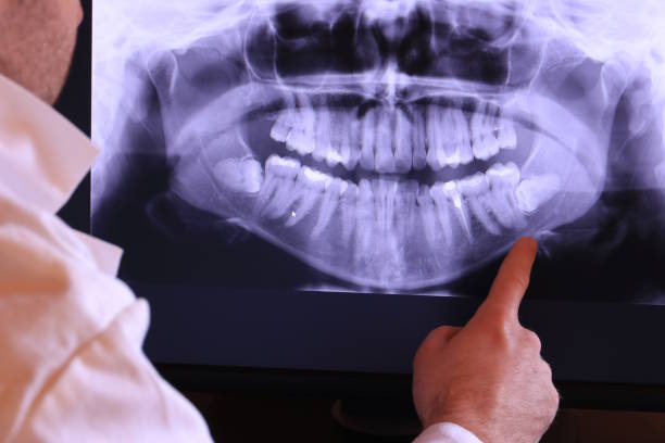 Best Emergency Dental Surgery in Bren Bow, OK